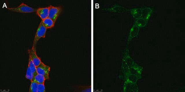 Anti-&#945;-galactosidase A Antibody