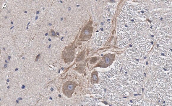 Anti-MRGPRX4 Antibody, clone 3F4 ZooMAb&#174; Rabbit Monoclonal recombinant, expressed in HEK 293 cells