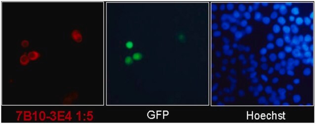 Anti-SARS-CoV-2 nucleocapsid Antibody, clone 7B10-3E4