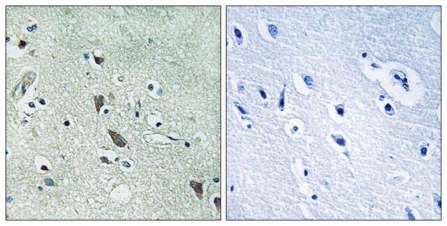 Anti-HTRA2 antibody produced in rabbit affinity isolated antibody