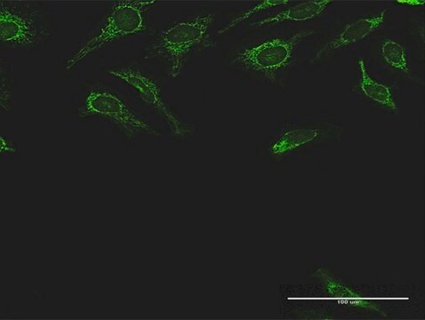 Anti-DLST antibody produced in rabbit purified immunoglobulin, buffered aqueous solution