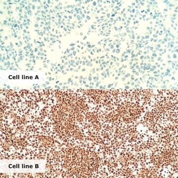 ALK-Lymphoma Analyte Control Cell line controls for immunohistochemistry and in situ hybridization