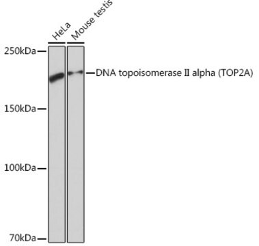 Anti-DNA topoisomerase II alpha (TOP2A) Antibody, clone 8V9C8, Rabbit Monoclonal