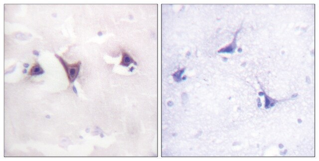 Anti-TRK B antibody produced in rabbit affinity isolated antibody