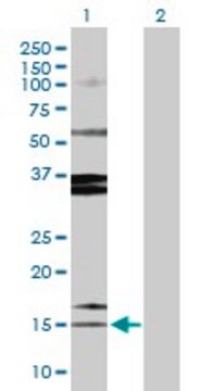 Anti-SPINK1 antibody produced in rabbit purified immunoglobulin, buffered aqueous solution