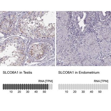 Anti-SLCO6A1 antibody produced in rabbit Prestige Antibodies&#174; Powered by Atlas Antibodies, affinity isolated antibody, buffered aqueous glycerol solution