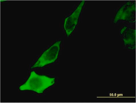 Monoclonal Anti-BDNF antibody produced in mouse clone 1B10, purified immunoglobulin, buffered aqueous solution