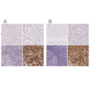 Anti-PRL antibody produced in rabbit Prestige Antibodies&#174; Powered by Atlas Antibodies, affinity isolated antibody