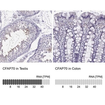 Anti-CFAP70 Prestige Antibodies&#174; Powered by Atlas Antibodies, affinity isolated antibody