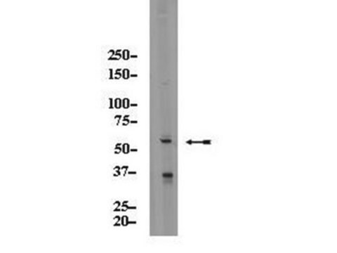 Anti-AIRE Antibody Upstate&#174;, from rabbit