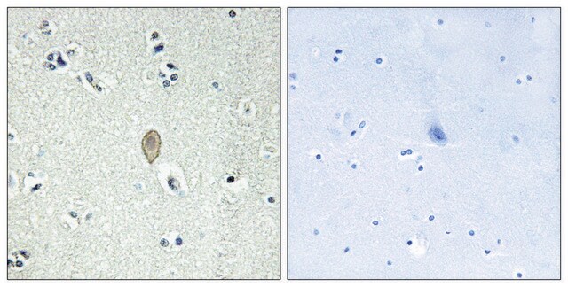 Anti-FZD5 antibody produced in rabbit affinity isolated antibody