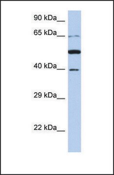 Anti-PNMA3, (N-terminal) antibody produced in rabbit affinity isolated antibody