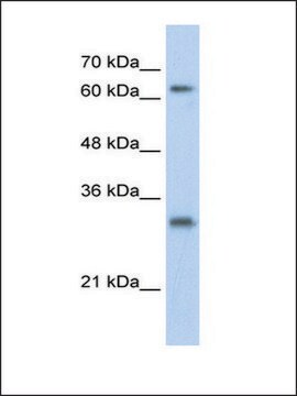 Anti-USP39 antibody produced in rabbit affinity isolated antibody