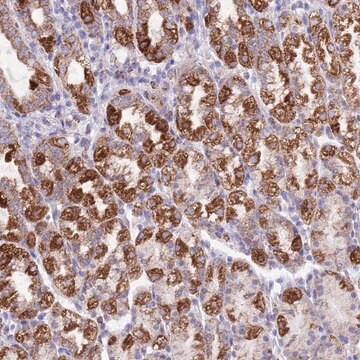 Anti-SS18L2 antibody produced in rabbit Prestige Antibodies&#174; Powered by Atlas Antibodies, affinity isolated antibody, buffered aqueous glycerol solution