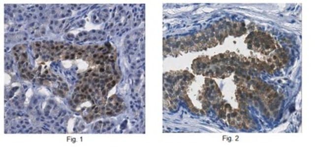 Anti-ATP-citrate synthase/ACLY Antibody from rabbit, purified by affinity chromatography