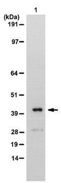 Anti-NET5 Antibody from rabbit, purified by affinity chromatography