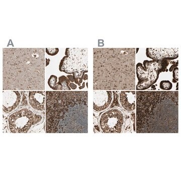 Anti-CANX antibody produced in rabbit Ab2, Prestige Antibodies&#174; Powered by Atlas Antibodies, affinity isolated antibody, buffered aqueous glycerol solution