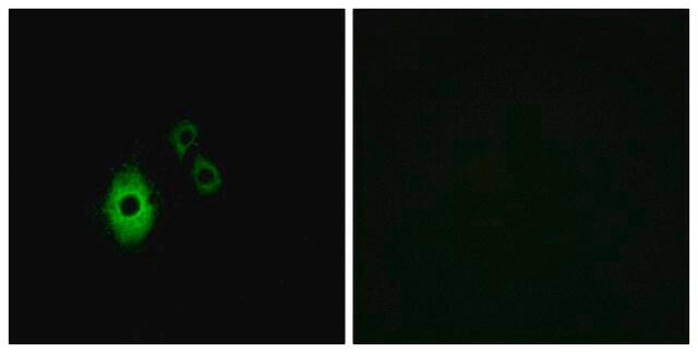 Anti-KCNJ5 antibody produced in rabbit affinity isolated antibody