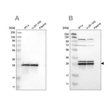 Anti-ETFB antibody produced in rabbit Prestige Antibodies&#174; Powered by Atlas Antibodies, affinity isolated antibody, buffered aqueous glycerol solution, Ab1