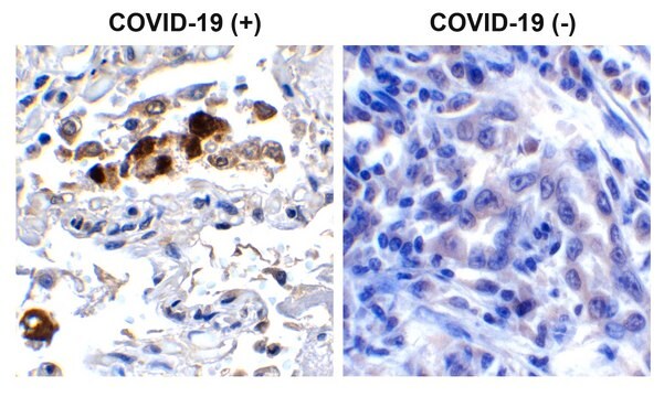 Anti-SARS-CoV-2 (COVID-19) Spike RBD antibody produced in rabbit affinity isolated antibody