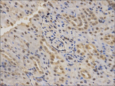 Anti-SMARCA4 antibody produced in rabbit affinity isolated antibody