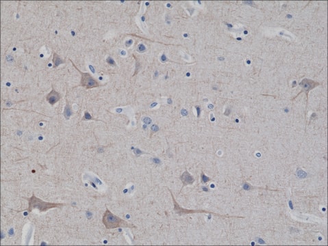 Anti-Neurofilament-l antibody, Rabbit monoclonal recombinant, expressed in HEK 293 cells, clone RM280, purified immunoglobulin