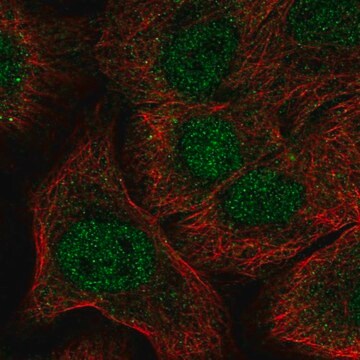 Anti-NOTCH1 antibody produced in rabbit Prestige Antibodies&#174; Powered by Atlas Antibodies, affinity isolated antibody