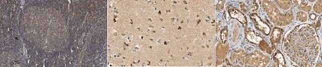 Anti-Cereblon Antibody, clone 3B12F7 clone 3B12F7, from mouse