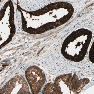 Anti-ACVR1C antibody produced in rabbit Ab1, Prestige Antibodies&#174; Powered by Atlas Antibodies, affinity isolated antibody, buffered aqueous glycerol solution