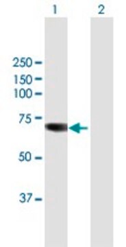 Anti-TKTL1 antibody produced in mouse purified immunoglobulin, buffered aqueous solution