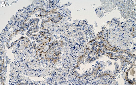 Anti-Laminin-5 Antibody, clone 1D3 ZooMAb&#174; Rabbit Monoclonal recombinant, expressed in HEK 293 cells