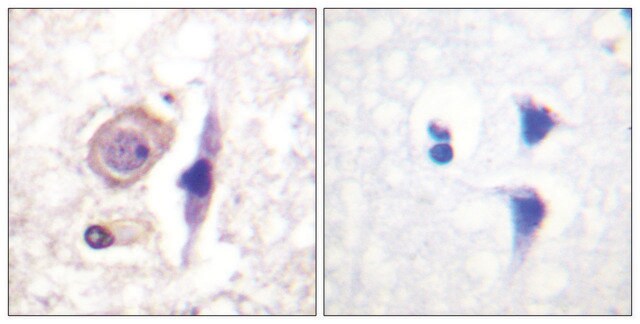 Anti-Interferon-&#947; Receptor &#945; chain antibody produced in rabbit affinity isolated antibody