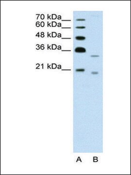 Anti-DNASE2B antibody produced in rabbit IgG fraction of antiserum