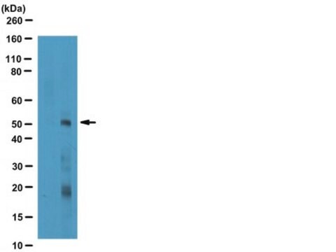 Anti-phospho-Smad3 (Ser423/425) Antibody from rabbit