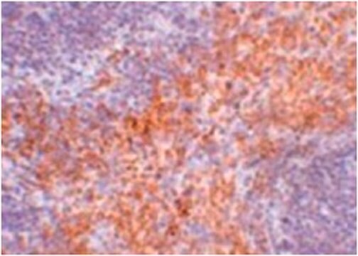 Anti-RIPK1 Antibody from rabbit, purified by affinity chromatography