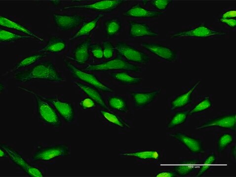 Anti-IGFBP3 antibody produced in rabbit purified immunoglobulin, buffered aqueous solution