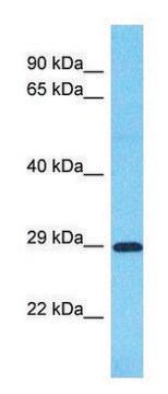 Anti-SLC25A35 antibody produced in rabbit affinity isolated antibody