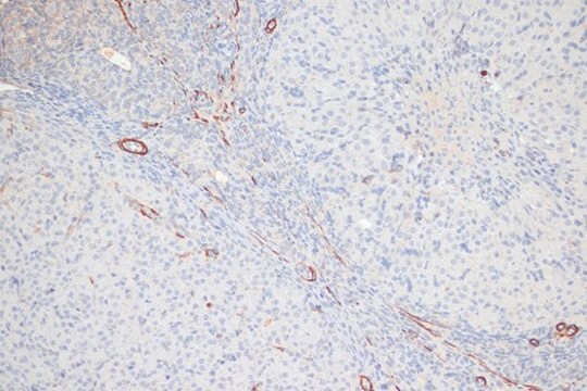 Anti-Phospho-MYL9-T18/S19 antibody produced in rabbit