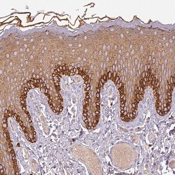 Anti-DAPK1 antibody produced in rabbit Prestige Antibodies&#174; Powered by Atlas Antibodies, affinity isolated antibody, buffered aqueous glycerol solution