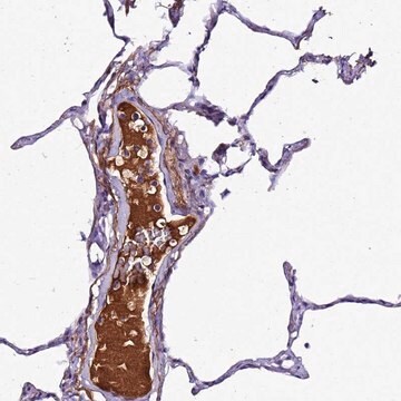 Anti-CFHR1 antibody produced in rabbit Prestige Antibodies&#174; Powered by Atlas Antibodies, affinity isolated antibody, buffered aqueous glycerol solution