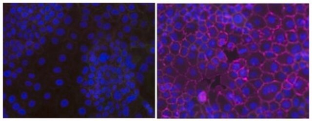 Anti-Phosphotyrosine Antibody, recombinant clone 4G10&#174; Antibody, Alexa Fluor&#8482; 647 clone 4G10, from mouse, ALEXA FLUOR&#8482; 647