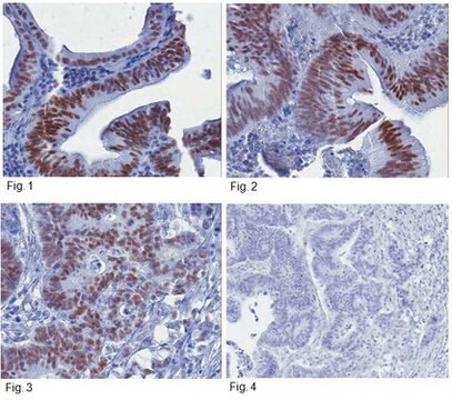 Anti-JMJD2A Antibody, clone 8B7.1, rabbit monoclonal clone 8B7.1, from rabbit