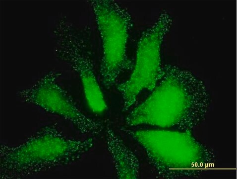 ANTI-LMO3 antibody produced in mouse clone 3G7, purified immunoglobulin, buffered aqueous solution