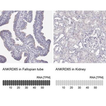 Anti-ANKRD65 antibody produced in rabbit Prestige Antibodies&#174; Powered by Atlas Antibodies, affinity isolated antibody, buffered aqueous glycerol solution