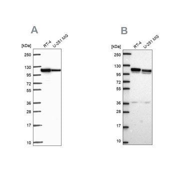 Anti-AP1B1 antibody produced in rabbit Prestige Antibodies&#174; Powered by Atlas Antibodies, affinity isolated antibody