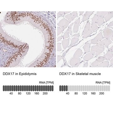 Anti-DDX17 antibody produced in rabbit Prestige Antibodies&#174; Powered by Atlas Antibodies, affinity isolated antibody, buffered aqueous glycerol solution