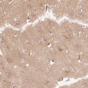 Anti-DCTN1 antibody produced in rabbit Prestige Antibodies&#174; Powered by Atlas Antibodies, affinity isolated antibody, buffered aqueous glycerol solution