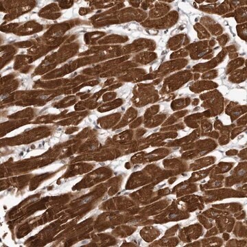 Anti-ABL1 antibody produced in rabbit Prestige Antibodies&#174; Powered by Atlas Antibodies, affinity isolated antibody, buffered aqueous glycerol solution, Ab1