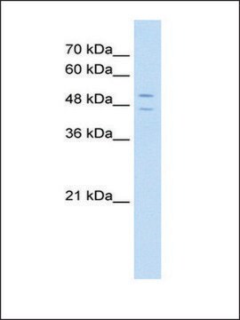 Anti-STEAP3 (AB2) antibody produced in rabbit IgG fraction of antiserum