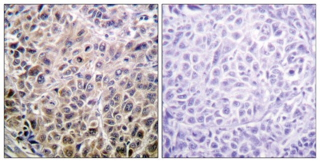 Anti-DAPK1 antibody produced in rabbit affinity isolated antibody